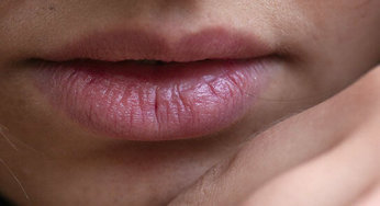 Temporomandibular Disorders