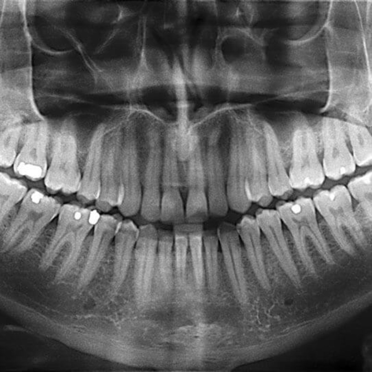 Dental X-Rays: It’s Time For Your Close-Up - Reynolds Dental, image size:1200x1200