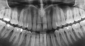 Dental X-Rays: It’s Time For Your Close-Up