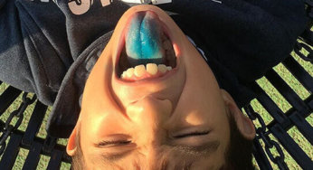 How Clean Is Your Tongue?