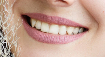 Let’s Raise Awareness of Oral Cancer